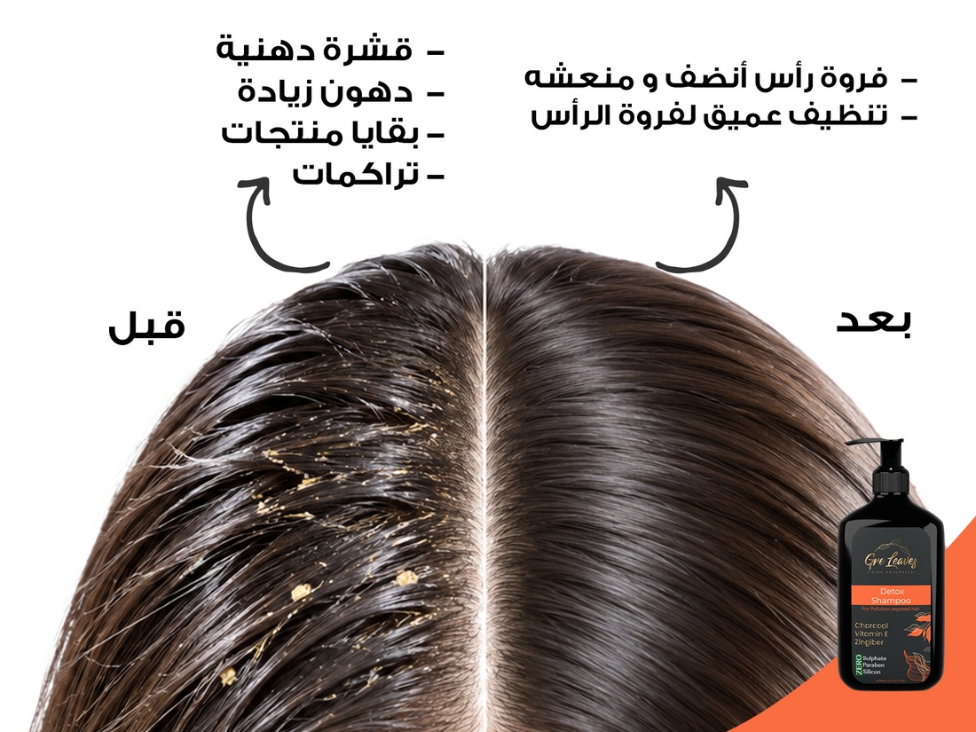 slider image slider_item_iFGeM7